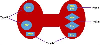 Thirty synchronous medullary and papillary thyroid carcinomas